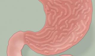 胃病转向胃癌5个信号 胃病有哪些症状会转变成胃癌